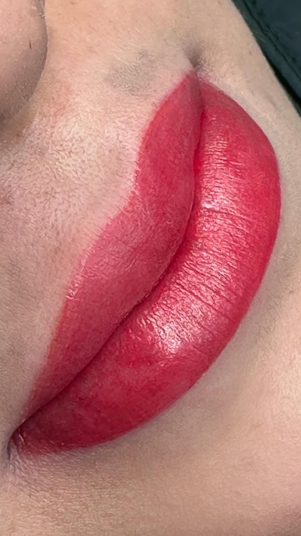 Labios antes