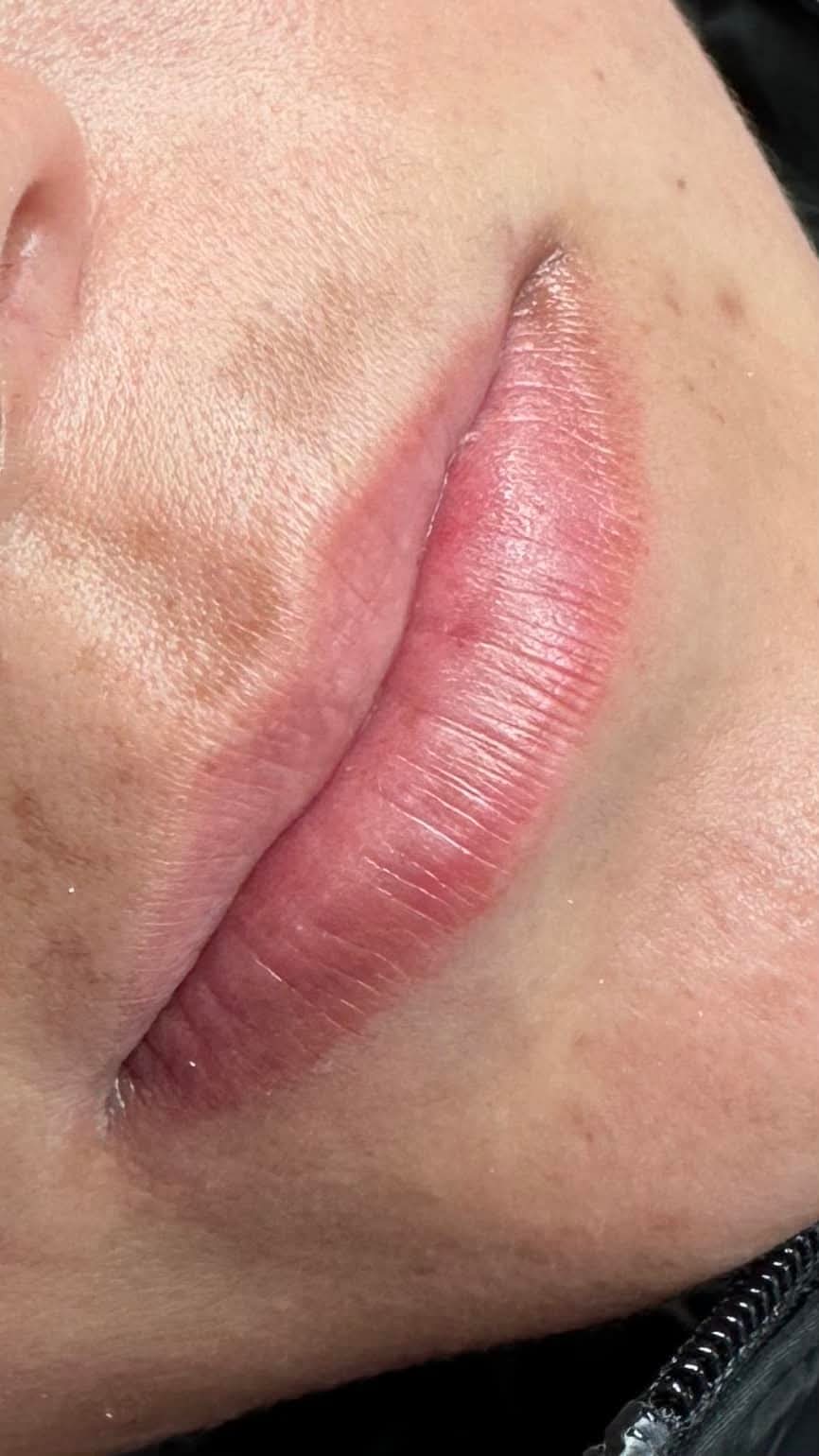 Labios después