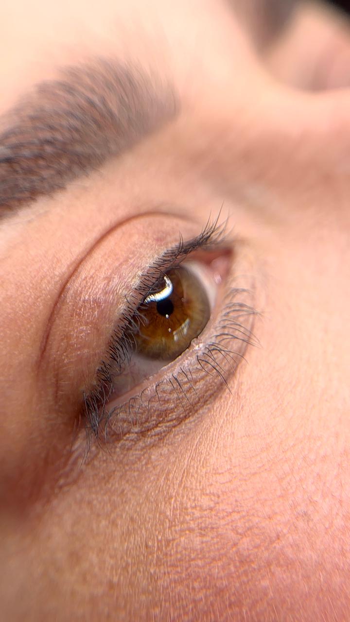 Ojos después